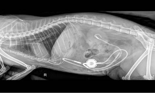 Subcutaneous ureteral bypass X-ray