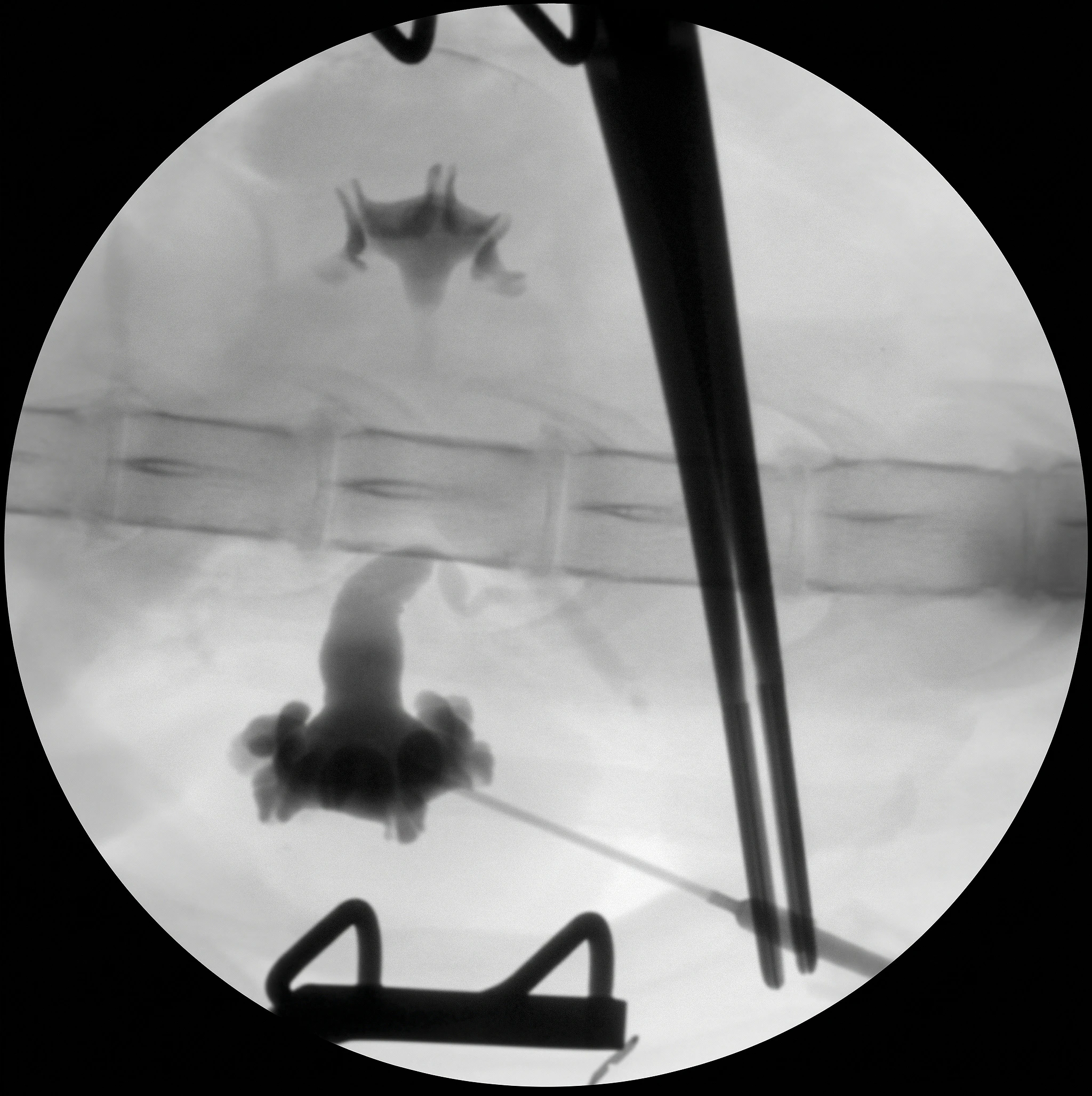 Subcutaneous Ureteral Bypass in Cats device